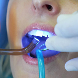 Laser Dentistry